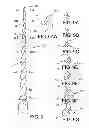 Fig. 10 - Endodontic instrument for drilling