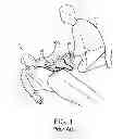 Fig. 02 - Universal AED training adapter