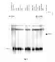 Fig. 07 - Urocortin-III and uses thereof