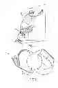 Fig. 02 - Athletic speed training device using biofeedback