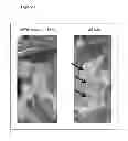 Fig. 02 - Compositions and methods for treating lung disease and injury