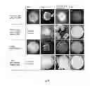 Fig. 06 - CARBOXYMETHYL STARCH AND CHITOSAN POLYELECTROLYTE COMPLEXES