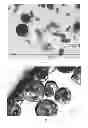 Fig. 16 - Dissolution of oxidized cellulose and particle preparation by cross-linking with multivalent cations