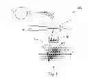 Fig. 02 - ASSEMBLY AND METHOD FOR CONFORMAL PARTICLE RADIATION THERAPY OF A MOVING TARGET