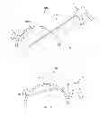 Fig. 02 - Micro laparoscopy devices and deployments thereof