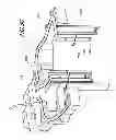 Fig. 08 - Optics for video cameras on a surgical visualization system