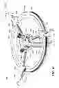 Fig. 17 - Optics for video cameras on a surgical visualization system