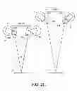Fig. 43 - Optics for video cameras on a surgical visualization system