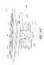 Fig. 85 - Optics for video cameras on a surgical visualization system