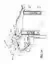 Fig. 06 - Surgical retractor with video cameras