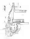 Fig. 07 - Surgical retractor with video cameras