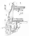 Fig. 08 - Surgical retractor with video cameras