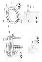 Fig. 09 - Surgical retractor with video cameras