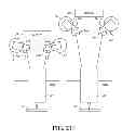 Fig. 44 - Surgical retractor with video cameras