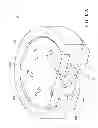 Fig. 89 - Surgical retractor with video cameras