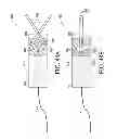 Fig. 97 - Surgical retractor with video cameras