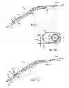 Fig. 02 - Illuminated suction apparatus