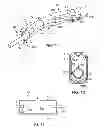 Fig. 09 - Illuminated suction apparatus