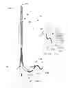 Fig. 02 - SYSTEMS AND METHODS FOR ANALYSIS AND TREATMENT OF A BODY LUMEN