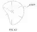 Fig. 09 - SYSTEMS AND METHODS FOR ANALYSIS AND TREATMENT OF A BODY LUMEN
