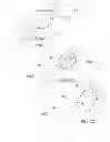 Fig. 11 - SYSTEMS AND METHODS FOR ANALYSIS AND TREATMENT OF A BODY LUMEN