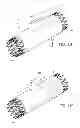 Fig. 02 - DEVICES, SYSTEMS, AND METHODS FOR REPAIR OF VASCULAR DEFECTS