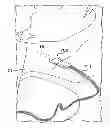 Fig. 01 - Cerebrospinal fluid evaluation system having thermal flow and flow rate measurement pad using a plurality of control sensors