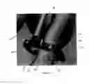 Fig. 07 - Tool and method for digital acquisition of a tibial mechanical axis