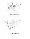 Fig. 02 - HAIR REMOVING DEVICE AND METHOD OF USE