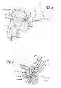 Fig. 02 - Flexible system for delivering an anchor