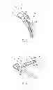 Fig. 04 - SURGICAL INSTRUMENTS WITH ARTICULATING SHAFTS