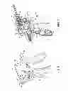 Fig. 06 - SURGICAL INSTRUMENTS WITH ARTICULATING SHAFTS