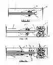 Fig. 02 - Vena cava filter catheter and method of use