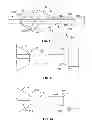Fig. 02 - Detachment mechanism for a central venous access filter and method of use
