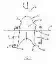 Fig. 02 - INTRA SPINOUS PROCESS AND METHOD OF BONE GRAFT PLACEMENT