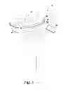 Fig. 06 - Surgical instrument and method of disassembling a tibial prosthesis