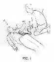 Fig. 02 - Defibrillator with protocol for selectively interrupting CPR