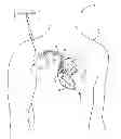 Fig. 01 - Criteria for optimal electrical resynchronization during biventricular pacing