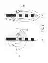 Fig. 09 - Movement disorder therapy system, devices and methods of tuning