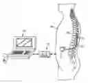 Fig. 01 - Neuromodulation system and method for reducing energy requirements using feedback