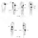 Fig. 10 - ELECTRICAL STIMULATION METHOD FOR REDUCTION OF JOINT COMPRESSION
