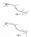 Fig. 02 - Method and apparatus for detection of lead reversal