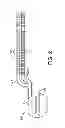 Fig. 03 - High frequency neuromodulation system and method for reducing energy requirements