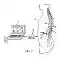 Fig. 06 - High frequency neuromodulation system and method for reducing energy requirements