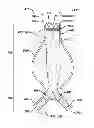 Fig. 01 - SEALING MECHANISM FOR EXPANDABLE VASCULAR DEVICE