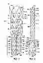 Fig. 02 - SEALING MECHANISM FOR EXPANDABLE VASCULAR DEVICE
