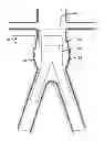 Fig. 01 - Endoluminal prosthetic conduit systems and method of coupling