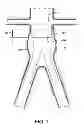 Fig. 02 - Endoluminal prosthetic conduit systems and method of coupling