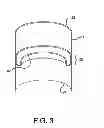 Fig. 04 - Endoluminal prosthetic conduit systems and method of coupling