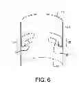 Fig. 07 - Endoluminal prosthetic conduit systems and method of coupling